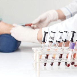 Các chỉ số xét nghiệm sinh hóa máu có ý nghĩa như thế nào?