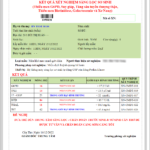 Phiếu kết quả xét nghiệm