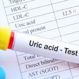 Ý nghĩa việc xét nghiệm acid uric máu và giải pháp khi acid uric tăng