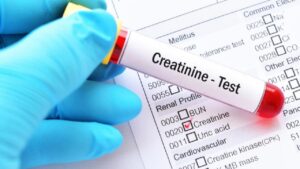 Xét nghiệm Máu Tổng quát – “Chiếc gương” Phản chiếu sức khỏe của Bạn