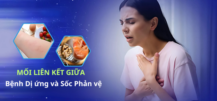 Mối liên kết giữa Bệnh Dị ứng và Sốc phản vệ